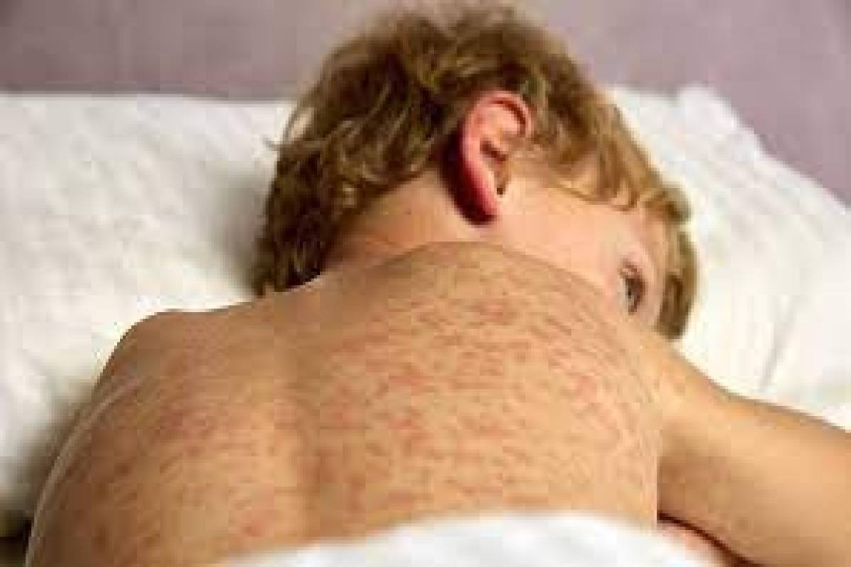 ����: vesti.az