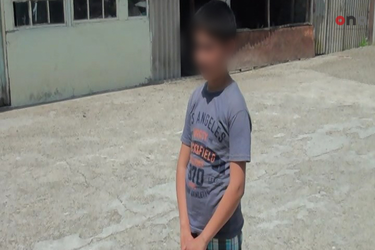 В Евлахе бездомная собака напала на 11-летнего ребенка - ФОТО