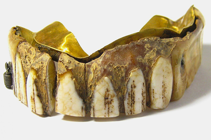 В Британии нашли 200-летнюю вставную челюсть из золота