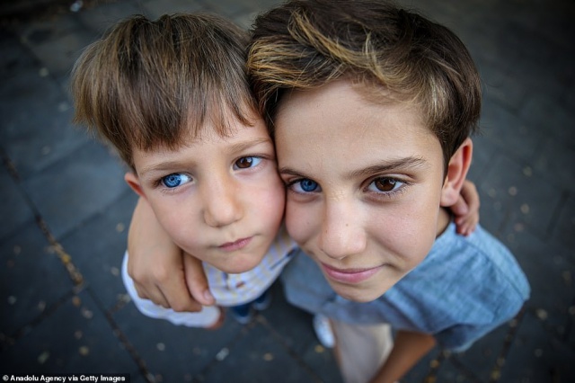 Разноцветные глаза сделали турецких мальчиков звездами интернета - ФОТО