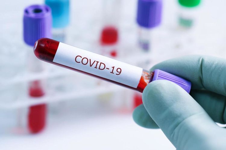 16 сотрудников Нацбанка Грузии заразились коронавирусом
