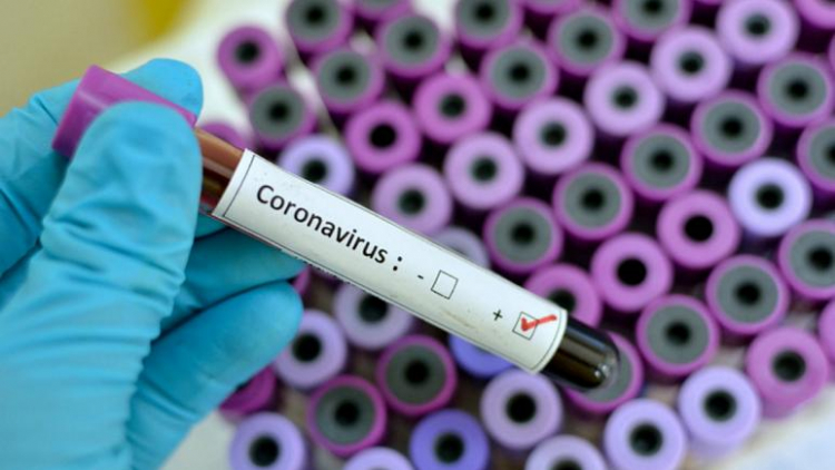 Число случаев заражения коронавирусом в Пакистане превысило 4,4 тысячи
