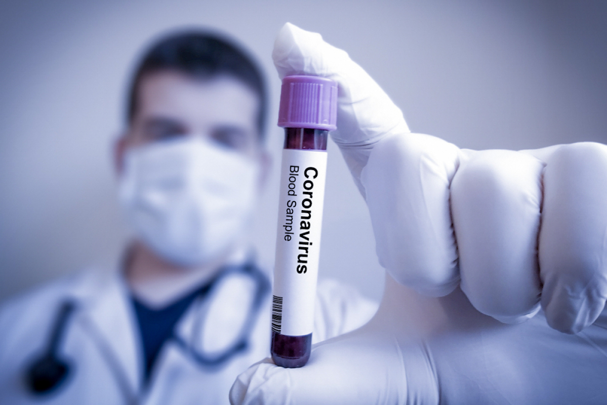 Борьба с коронавирусом под полным контролем! – НАМ ПИШЕТ ДЕПУТАТ МИЛЛИ МЕДЖЛИСА
