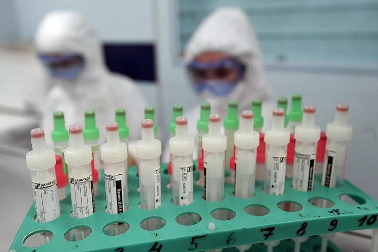 TƏBİB: В Азербайджане с тестированием на коронавирус никаких проблем нет
