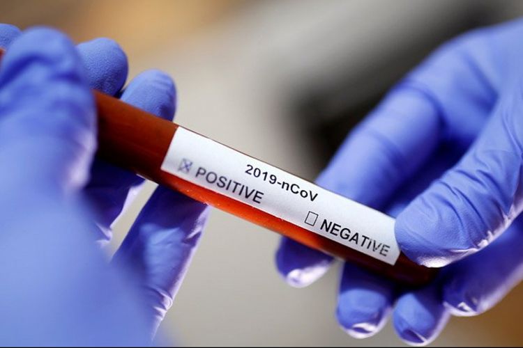 В США провели 60 млн тестов на коронавирус