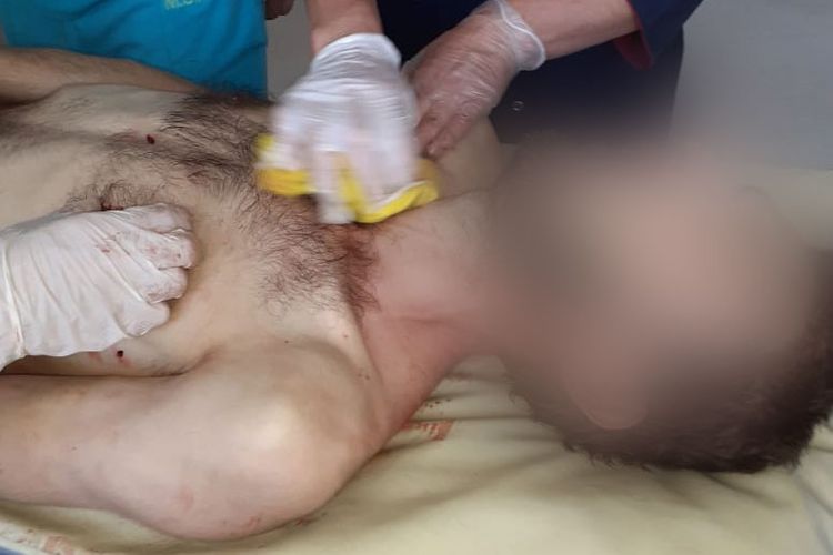 Житель Баку убил ножом брата