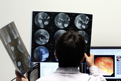 Раскрыты первые признаки рака желудка
