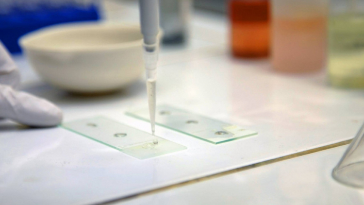 В Азербайджан доставлены все необходимые средства против коронавируса - Минздрав