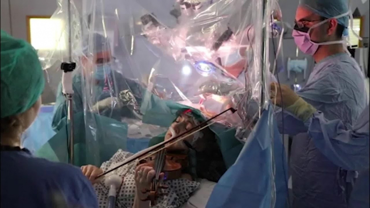 Пациентку заставили играть на скрипке во время операции на мозге - ВИДЕО