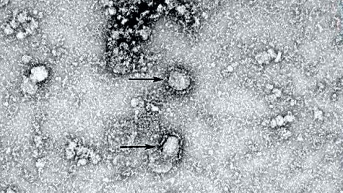 Китай опубликовал снимок нового коронавируса
