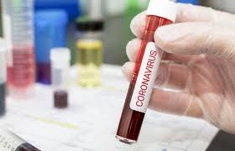 Расширен список лабораторий, в которых авиапассажиры могут пройти проверку на COVID-19 