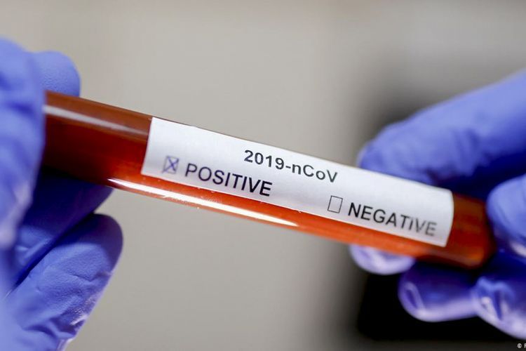 В США за сутки выявили 57,5 тыс. новых случаев заражения коронавирусом