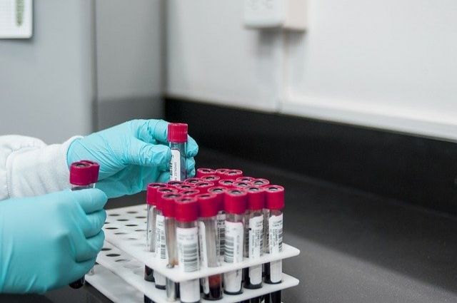 В Азербайджане проведено 537 тысяч тестов на коронавирус
