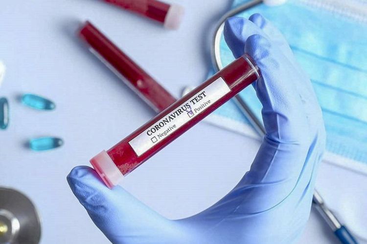 Количество проведенных в Азербайджане тестов на коронавирус превысило 700 тысяч
