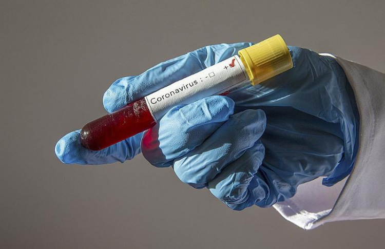 Ученый прогнозирует вторую волну коронавируса в декабре
