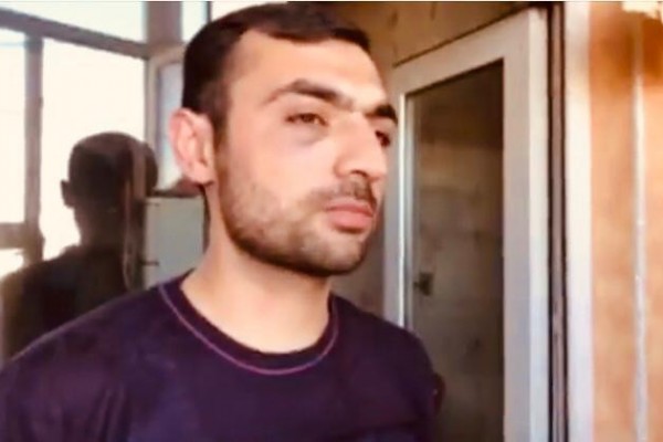 Полиция Баку о побоях на лице задержанного в Ясамале нарушителя правопорядка 
