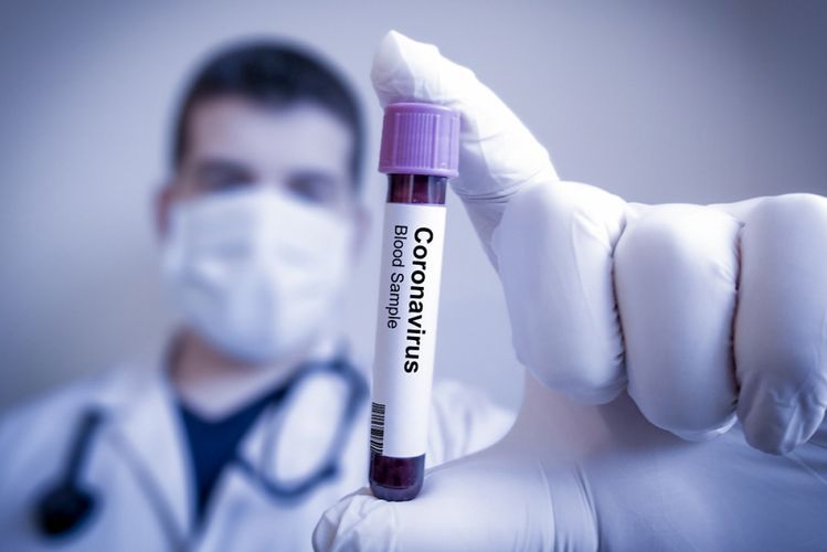 Число жертв коронавируса в Азербайджане в 5 раз меньше мирового показателя
