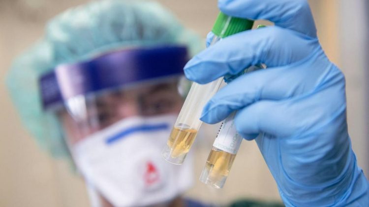 В Азербайджане проведено 391 699 тестов на коронавирус
