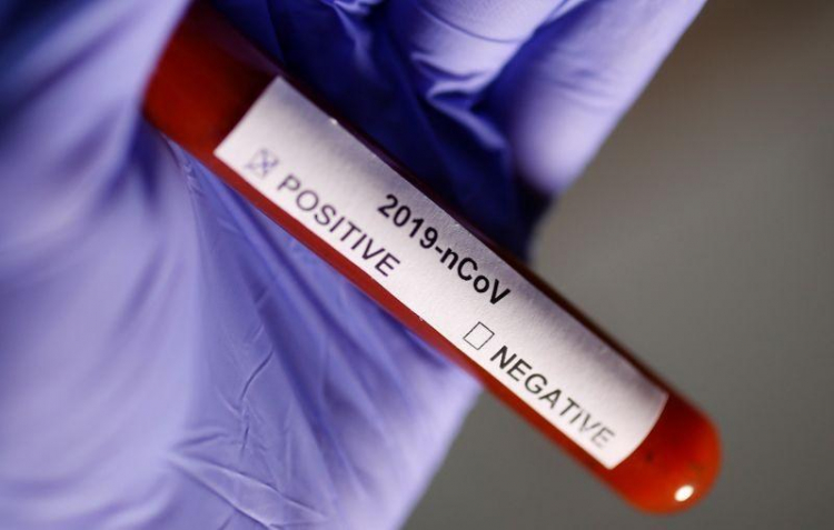 В Азербайджане число заразившихся коронавирусом достигло 12 729 человек
