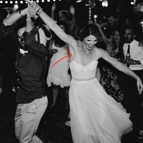 Невеста обнаружила у себя смертельную болезнь и теперь готовится к операции - ФОТО