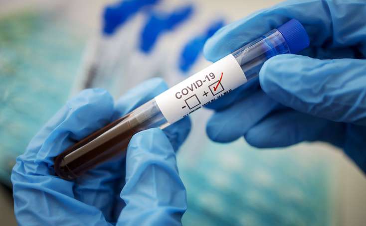 В Азербайджане выявлен 521 новый случай заражения коронавирусом