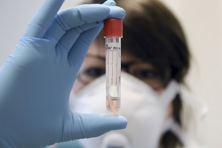 В Азербайджане проведено 482 170 тестов на коронавирус
