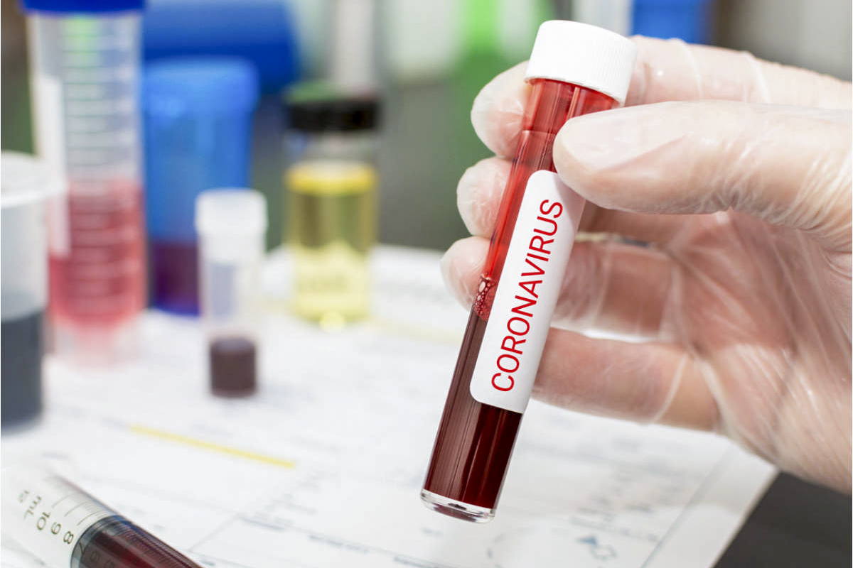 Вы подозреваете, что заражены коронавирусом?– ПОШАГОВАЯ ИНСТРУКЦИЯ
