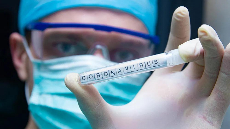 В Азербайджан дополнительно завезли 3 тыс. тестов для выявления коронавируса