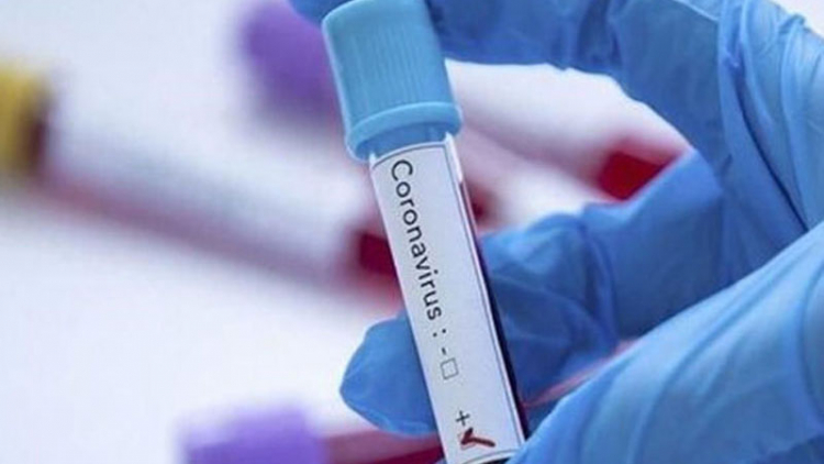 ХОРОШАЯ НОВОСТЬ: В Азербайджане растет число излечившихся от коронавируса