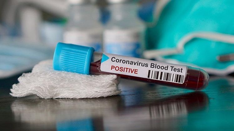 ВОЗ не рекомендует проводить тест на коронавирус по личному желанию