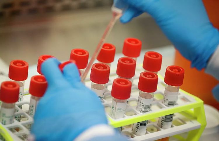 В Сингапуре зарегистрировали два первых случая смерти от коронавируса