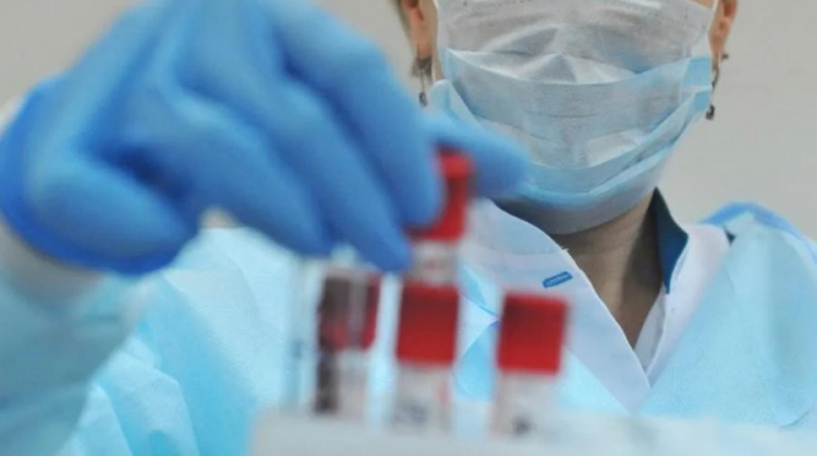 Число случаев коронавируса в Узбекистане выросло до 88
