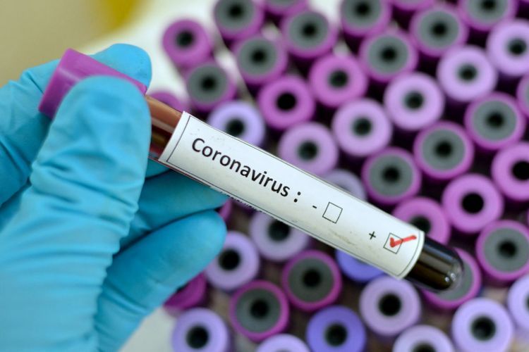 Обнародован процент инфицирования коронавирусом в Азербайджане
