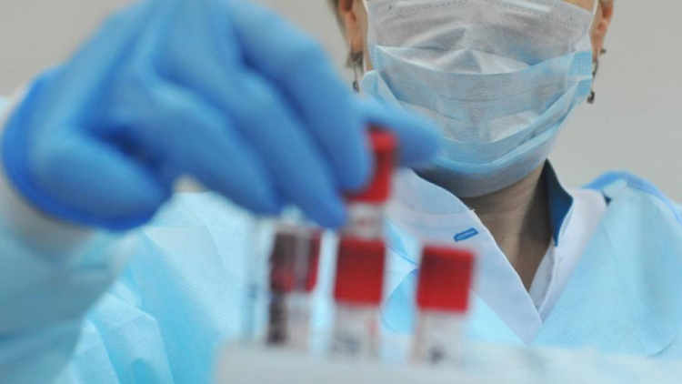 В Азербайджане выявлены 136 новых случаев инфицирования коронавирусом