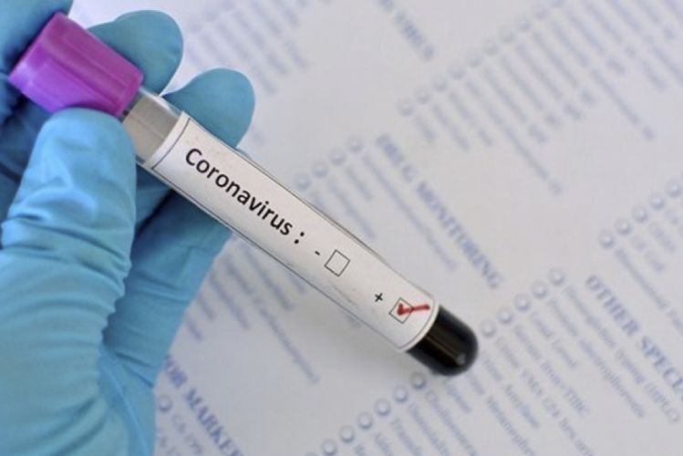В Азербайджане число инфицированных коронавирусом достигло 60 873 человека