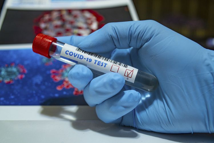 В Азербайджане число инфицированных коронавирусом достигло 68 594 человека