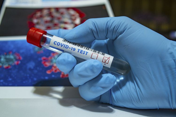 В Азербайджане число инфицированных коронавирусом достигло 70 216 человек