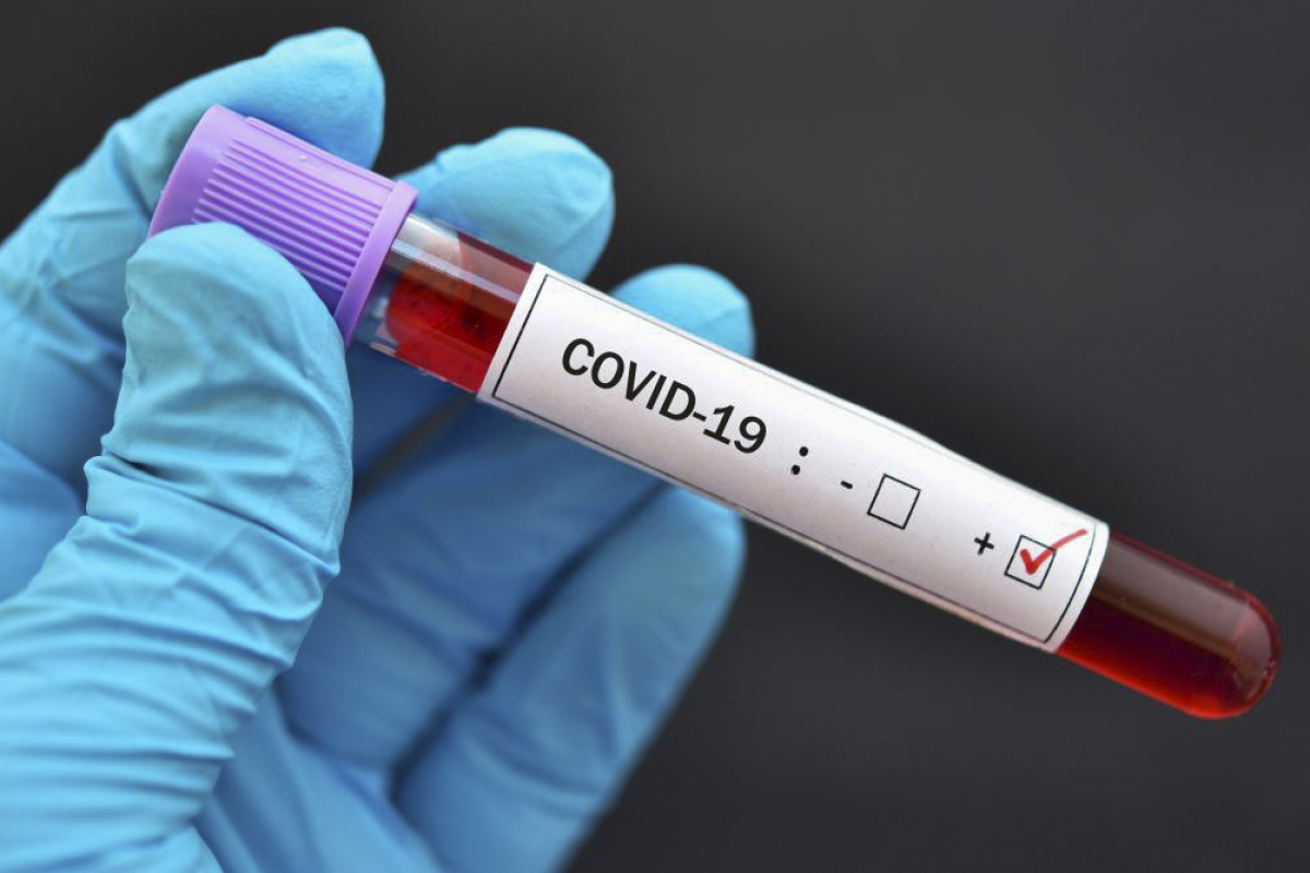 В Грузии за последние сутки коронавирусом заразились 87 человек