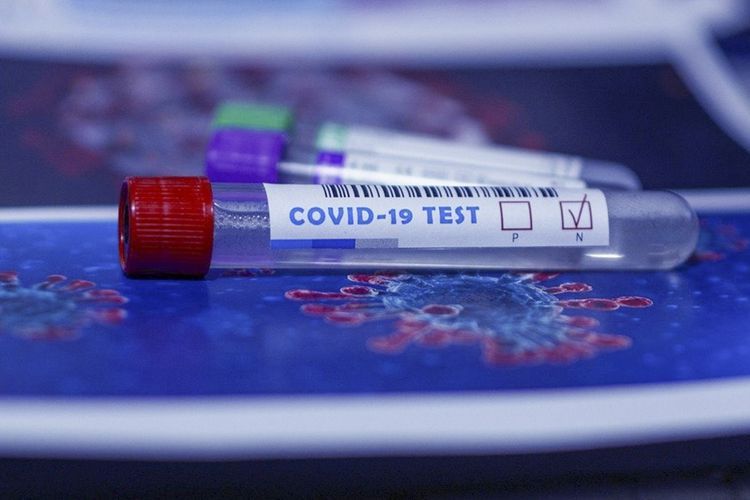 В Иране за последние сутки от коронавируса умерли 144 человека