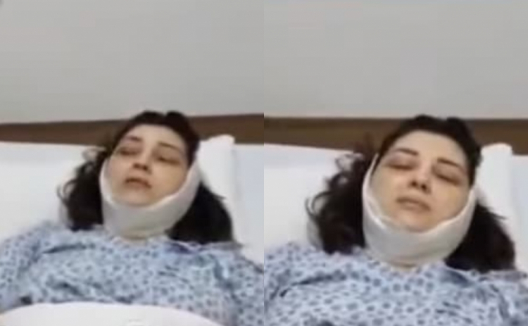 Азербайджанская певица легла  под нож пластического хирурга
