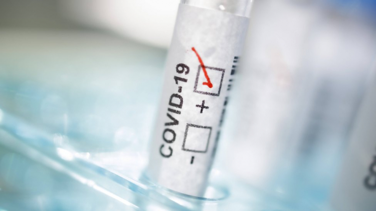 Создан точный и универсальный тест на коронавирус