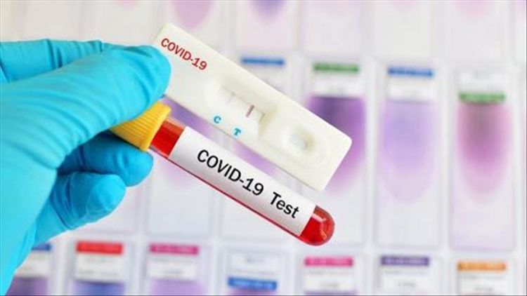 В Азербайджане общее число инфицированных коронавирусом достигло 228 975 человек