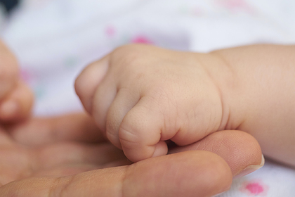 Женщина родила мальчика с одним мозгом на две головы