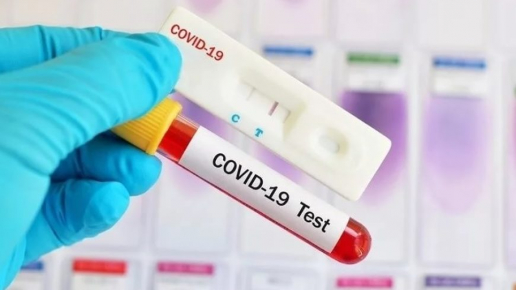 В Азербайджане за сутки выявлено 509 случаев заражения COVID-19