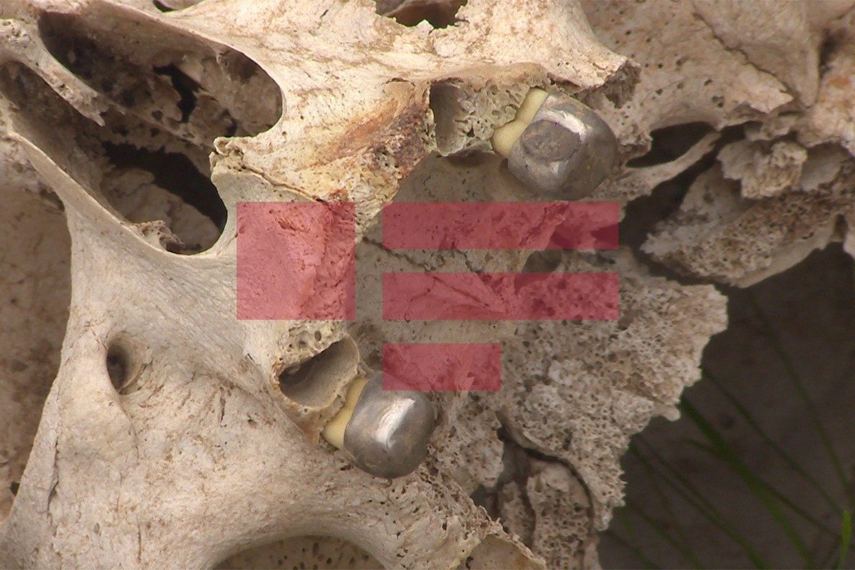 Очередное доказательство вандализма армян: разрушенное кладбище и вырванные у трупов золотые зубы-ФОТО 