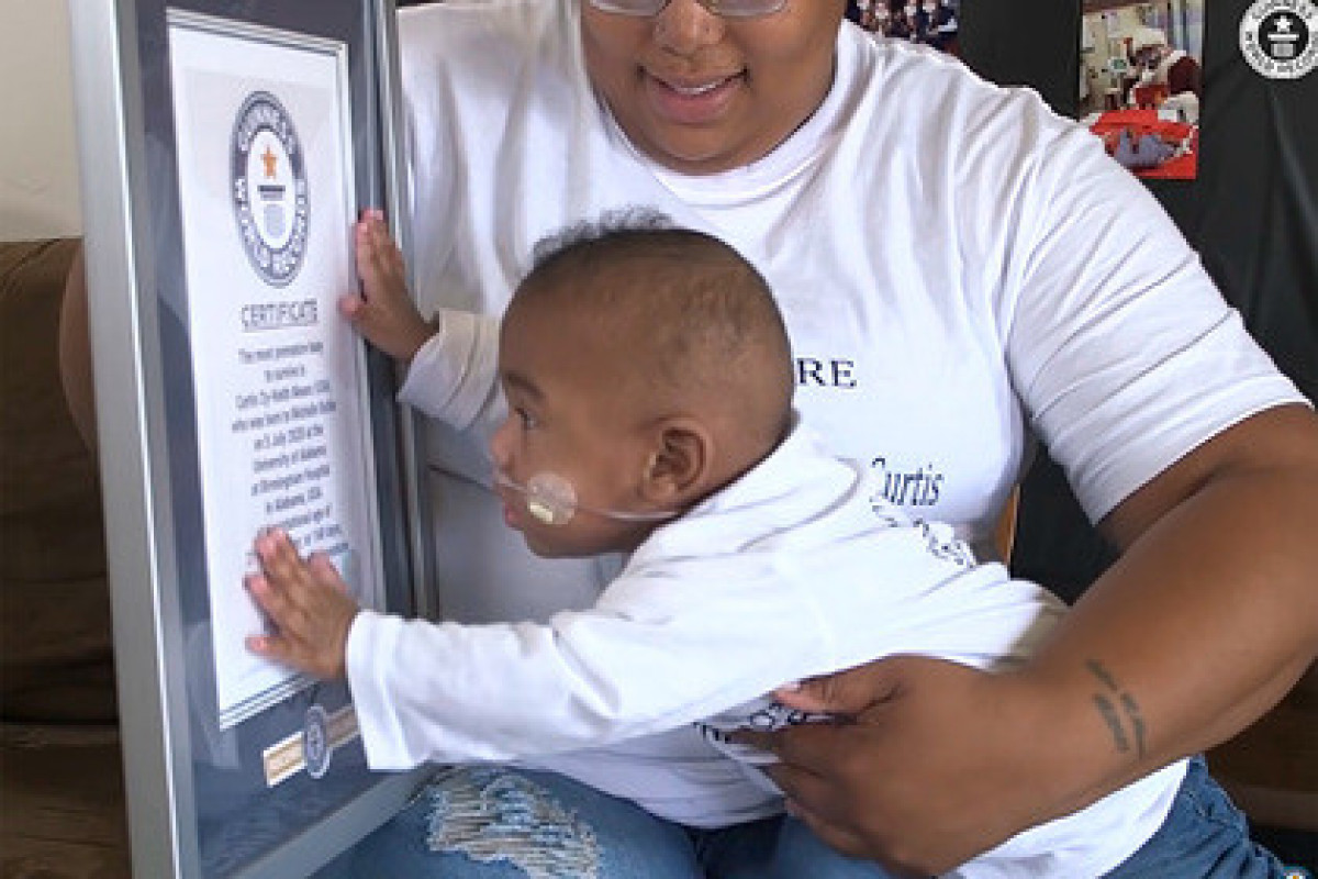 Самый недоношенный ребенок в мире выжил и установил рекорд