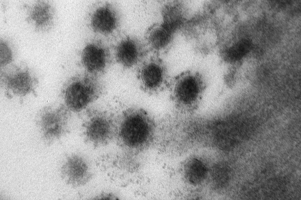 Ученые заявили о самоликвидации дельта-штамма коронавируса
