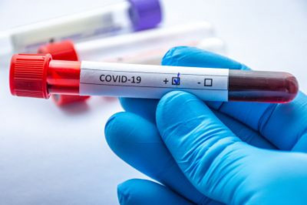 Вирусолог объяснила, почему тесты на COVID-19 бывают ложноотрицательными