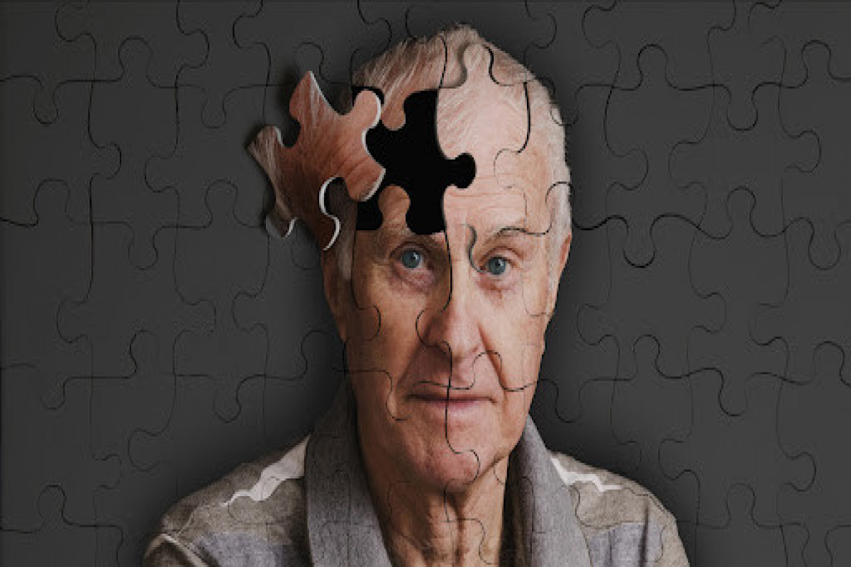 Ученые назвали первые признаки деменции