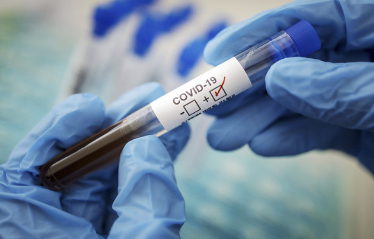 Число инфицирвоанных COVID-19 в Армении достигло 263783